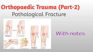 OrthopaedicTraumapart2 Pathological Fracture with notes [upl. by Htehpaj]