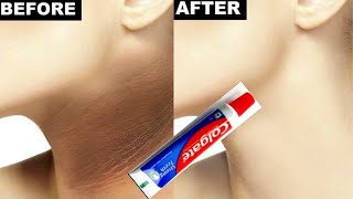 Colgate toothpaste for neck whitening  How to remove black neck with colgate  Colgate on neck [upl. by Ahtiekal121]