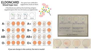 Blood type testing with Eldoncards home test kits amp ABO blood type basics [upl. by Enyaj]