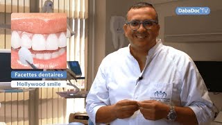 Dr Mohamed Tajmouati  Hollywood Smile  Facettes dentaires [upl. by Arobed]