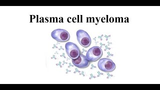 Plasma Cell Myeloma [upl. by Winne]