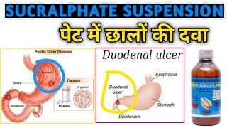 Sucralphate suspension  पेट में छालों घावों की दवा  Sucralphate  Sucrafil suspension [upl. by Pelagia]