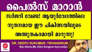 PILES AYURVEDIC TREATMENT  PILES  പൈൽസ്  PILES TREATMENT MALAYALAM മൂലക്കുരു [upl. by Nanda100]