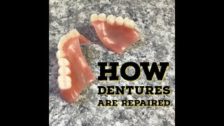 How Dentures Are RepairedFixed [upl. by Llemaj]