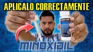 🧔🏻‍♂️ Como aplicar MINOXIDIL en la BARBA con GOTERO 💧 Por primera vez [upl. by Azal]