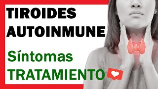 Tiroides Autoinmune o Tiroiditis de Hashimoto SINTOMAS y TRATAMIENTO ✅ [upl. by Aeduj]