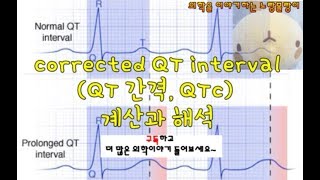 corrected QT intervalQT 간격 QTc 계산과 해석 [upl. by Ahar]