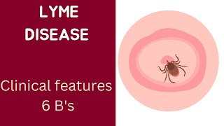 quotLyme Disease The 6 Bs of Borrelia Burgdorferiquot [upl. by Kwang825]