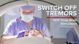 21 Examination of a Patient with Essential Tremor  Tremors Spring Video Atlas [upl. by Fax]