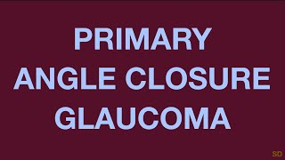 Glaucoma Session 14 Primary Angle Closure Glaucoma [upl. by Ahsaetan33]