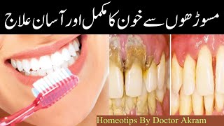 Masudo Se Blood Aane Ka Ilaj  Gums Bleeding Treatment In Urdu Danto Se Khoon Ane Ka Wajah Aur Ilaj [upl. by Bennet3]