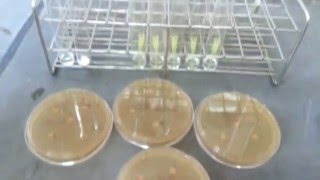 Carbohydrate assimilation test of various yeasts [upl. by Irb]