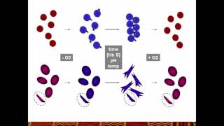 Pathophysiology of sickle cell anemia [upl. by Damalis]