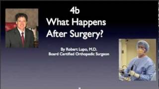 Recovery after Rotator Cuff Surgerymov [upl. by Pollack]