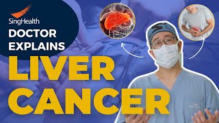 Doctor Explains Liver Cancer  Humans CANNOT Survive without a Liver [upl. by Ledarf]