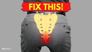 How to Fix Tailbone Pain for Good [upl. by Notnroht]