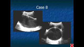 RADIOLOGY EXAM CASES [upl. by Irmo979]