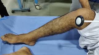 Hyperreflexia Ankle and Knee Reflex [upl. by Lessur]