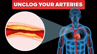 Clogged Arteries Shocking Symptoms amp Natural Solutions FAST [upl. by Stelmach912]