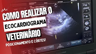 COMO REALIZAR ECOCARDIOGRAMA  Entenda o posicionamento para o exame e os cortes ecocardiográficos [upl. by Eberhard160]