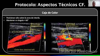 Doppler Arterias Carótidas y Vertebrales  Dr Daniel Sandoval Guerra [upl. by Leffen]