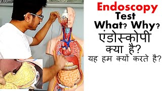 Endoscopy test in Hindi [upl. by Affay]