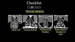 Preop FESS Checklist  Dr Suresh Mukherji  Medality MRI Online Radiology Noon Conference [upl. by Tomkiel]