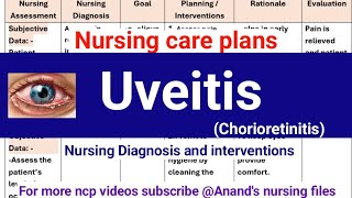 Uveitis nursing care plansChorioretinitis nursing care plans [upl. by Esinek]