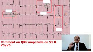 EKG Trainer Case 5 Questions [upl. by Anuska]