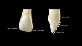 Anatomia e Morfogia Dental [upl. by Assenar]