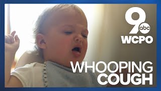 Sound of whooping cough [upl. by Gromme]