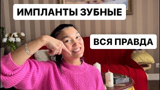 ЗУБНЫЕ ИМПЛАНТЫ▪️КАК ВСЁ БЫЛО🔸ИМПЛАНТАЦИЯ ЗУБОВ [upl. by Eceinej]