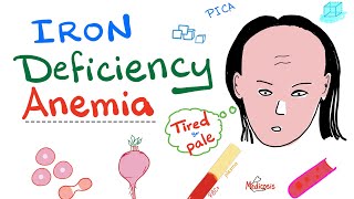 Iron Deficiency Anemia  All you need to know  Causes Symptoms Diagnosis Treatment [upl. by Assertal]