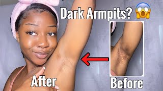 HOW TO LIGHTEN YOUR UNDERARMS WITH ONLY 1 PRODUCT  Fast and Effective treatment [upl. by Entsirhc216]