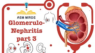 Glomerulonephritis GN part 3 Nephritc syndrome by ASM Minds [upl. by Nohsreg943]