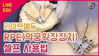 라이브에듀 RPE악궁확장장치 셀프 사용법 [upl. by Harlie261]