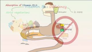 Megaloblastic Anemia Part 1 Vitamin B12 Deficiency Anemia [upl. by Zinah914]