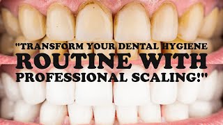 quotTransform Your Dental Hygiene Routine with Professional Scalingquot [upl. by Adnauqal376]