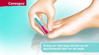 Canespro Behandeling Voor Schimmelnagels  TV Reclame [upl. by Neerom272]