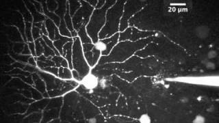 Two photon imaging in the PV retina [upl. by Mersey436]