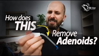 The weird way surgeons remove your adenoids [upl. by Johanan]