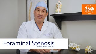 Foraminal Stenosis  360 Ortho amp Spine [upl. by Amsirhc]