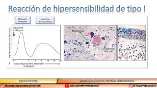 Reacción de hipersensibilidad tipo I Inmediata  IgE [upl. by Eceirahs886]