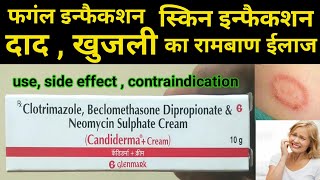 candiderma plus cream use  fungal infection daad khaj khujli ki dawa  skin infection treatment [upl. by Larkin]