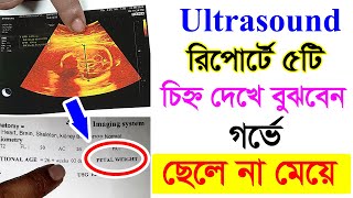 আল্ট্রাসাউন্ড রিপোর্টে যে ৫ টি চিহ্ন দেখে যেভাবে নিজে বুঝবেন ছেলে না মেয়ে হবে  Ultrasound report1 [upl. by Franci361]