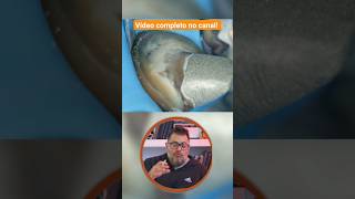 Técnicas de Cimentação Adequada  dente restauração odontologia dentista shorts [upl. by Everick836]