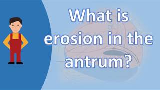 What is erosion in the antrum   Best and Top Health FAQs [upl. by Arev]