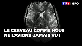 Le cerveau comme nous ne lavions jamais vu  Les images inédites de lIRM le plus puissant du monde [upl. by Latoye541]