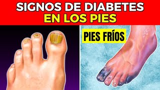 8 Señales en TUS PIES que INDICAN DIABETES [upl. by Eila379]