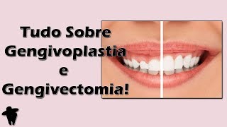 Aula de Periodontia  Tudo Sobre Gengivoplastia e Gengivectomia  Indicações e Passo a Passo [upl. by Johnstone]